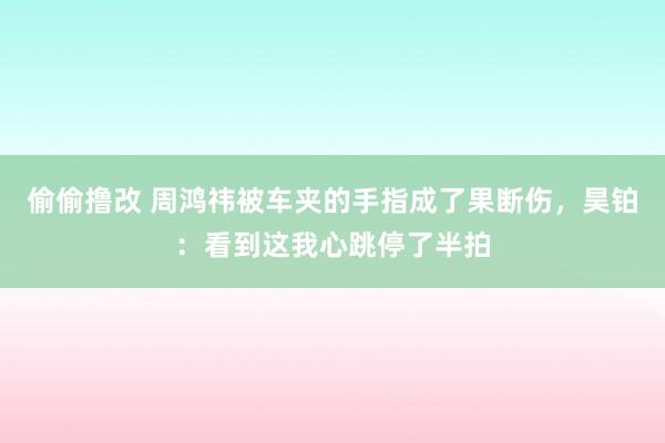 偷偷撸改 周鸿祎被车夹的手指成了果断伤，昊铂：看到这我心跳停了半拍